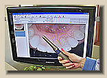 Intra-oral dental cameras